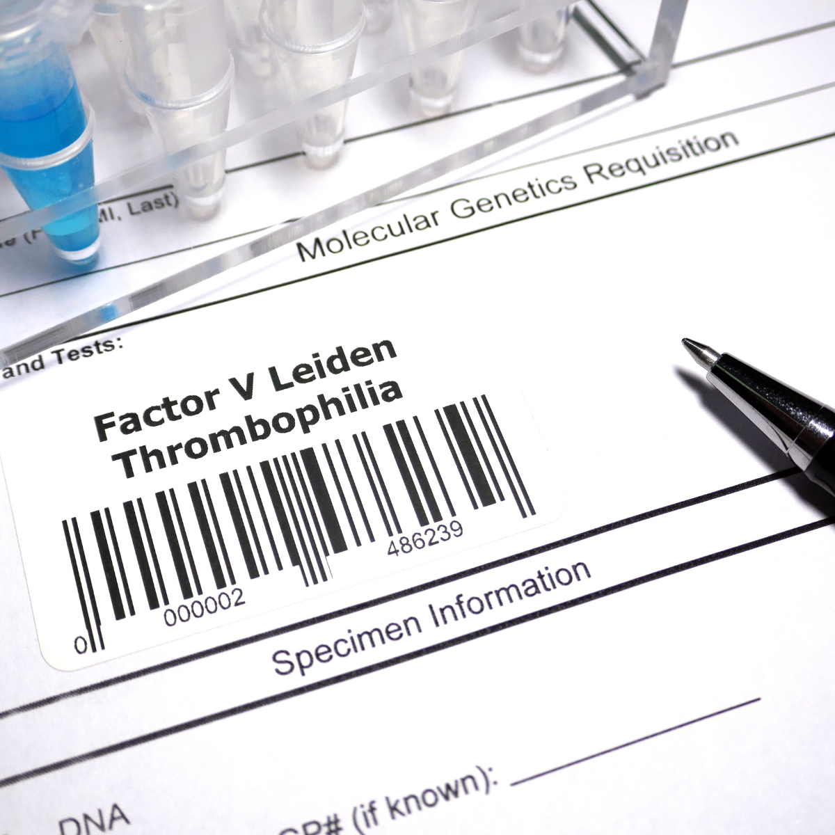 Factor V Leiden Thrombophilia