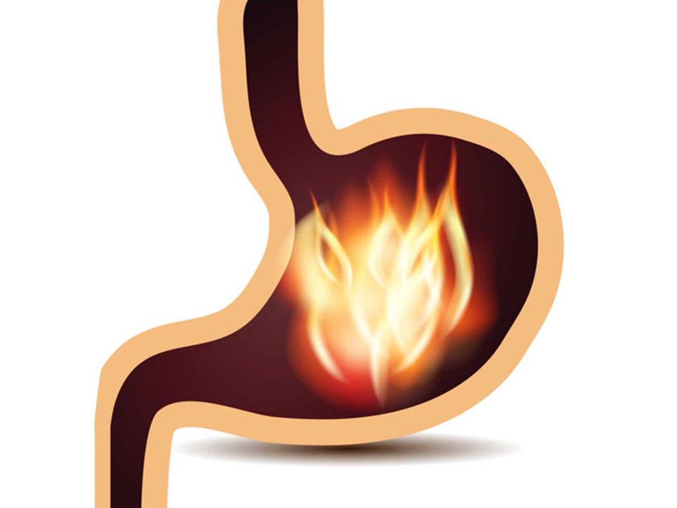 Facts about peptic ulcer