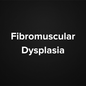 Fibro Muscular Dysplasia