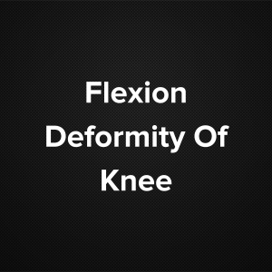 Flexion Deformity of Knee