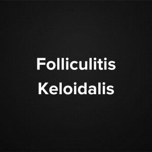 Folliculitis Keloidalis