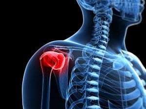 Frozen shoulder : The diabetic connection