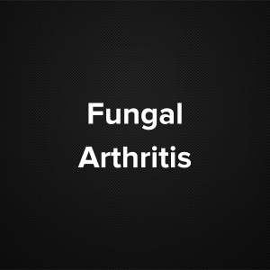 Fungal Arthritis