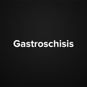 Gastroschisis