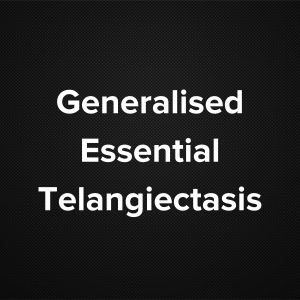 Generalized Essential Telangiectasis