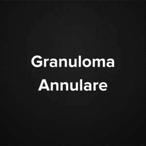 Granuloma Annulare