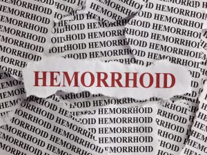 Haemorrhoids