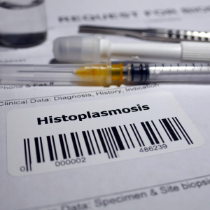 Histoplasmosis