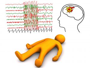 How to communicate with a patient who has a stroke