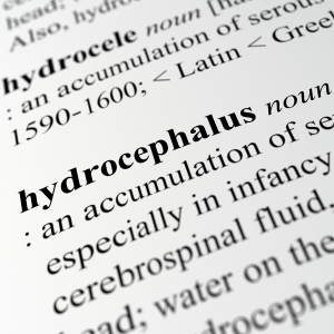 Hydrocephalus