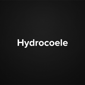 Hydrocele