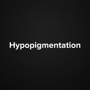 Hypopigmentation