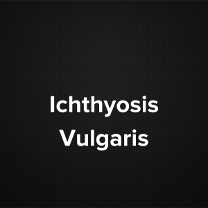 Ichthyosis Vulgaris