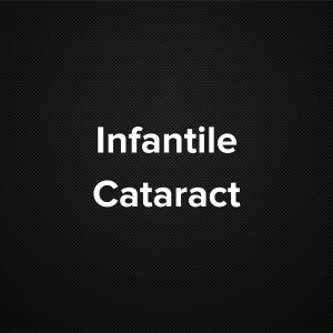 Infantile Cataract