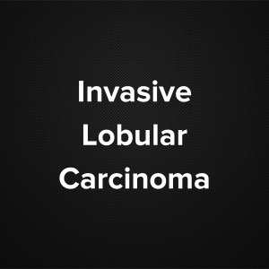 Invasive Lobular Carcinoma