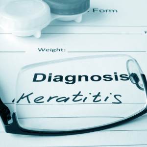 Keratitis