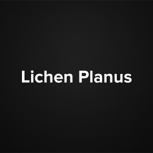 Lichen Planus