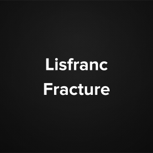 Lisfranc Fracture