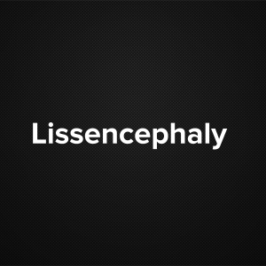 Lissencephaly