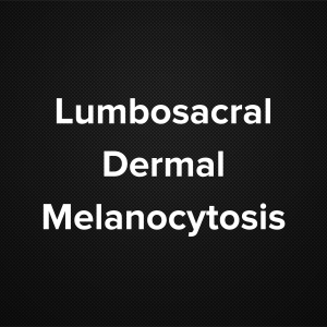 Lumbosacral Dermal Melanocytosis