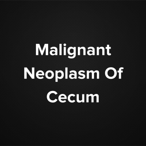 Malignant Neoplasm Of Cecum