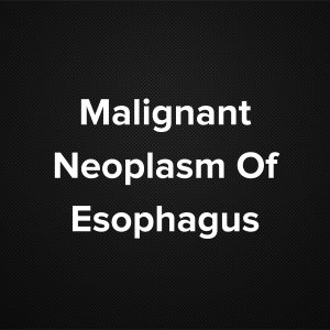 Malignant Neoplasm Of Esophagus