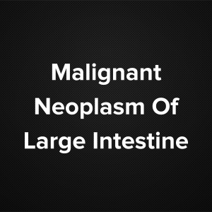 Malignant Neoplasm Of Large Intestine