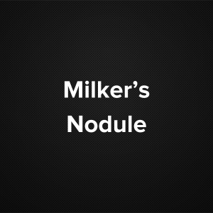 Milker’s Nodule