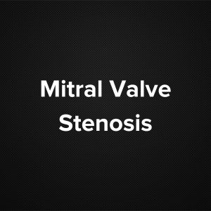 Mitral Valve Stenosis