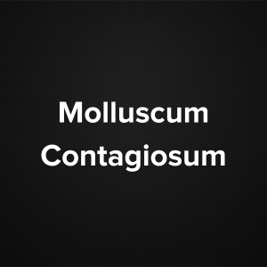 Molluscum Contagiosum (Water Warts)