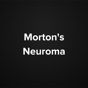 Morton’s Neuroma