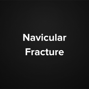 Navicular Fracture