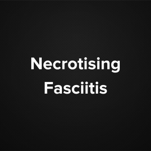 Necrotizing Fasciitis