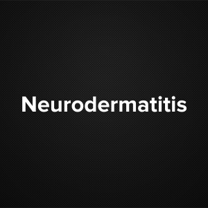 Neurodermatitis (Lichen Simplex Chronicus, Circumscribed Neurodermatis)