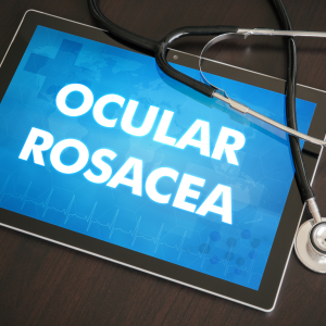 Ocular Rosacea