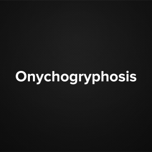 Onychogryphosis