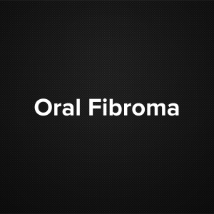 Oral Fibroma