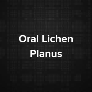 Oral Lichen Planus