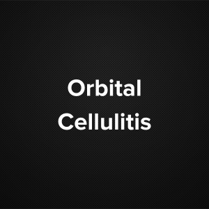 Orbital Cellulitis