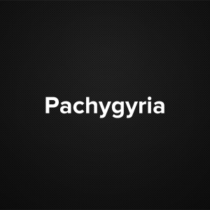 Pachygyria