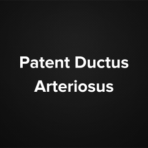 Patent Ductus Arteriosus