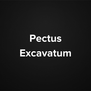 Pectus Excavatum