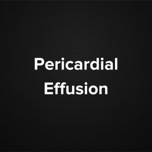 Pericardial Effusion