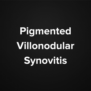 Pigmented Villonodular Synovitis