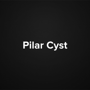 Pilar Cyst