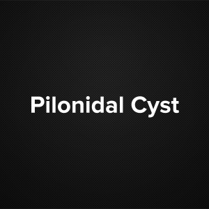 Pilonidal Cyst