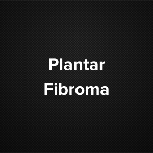 Plantar Fibroma