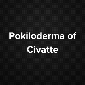 Poikiloderma of Civatte