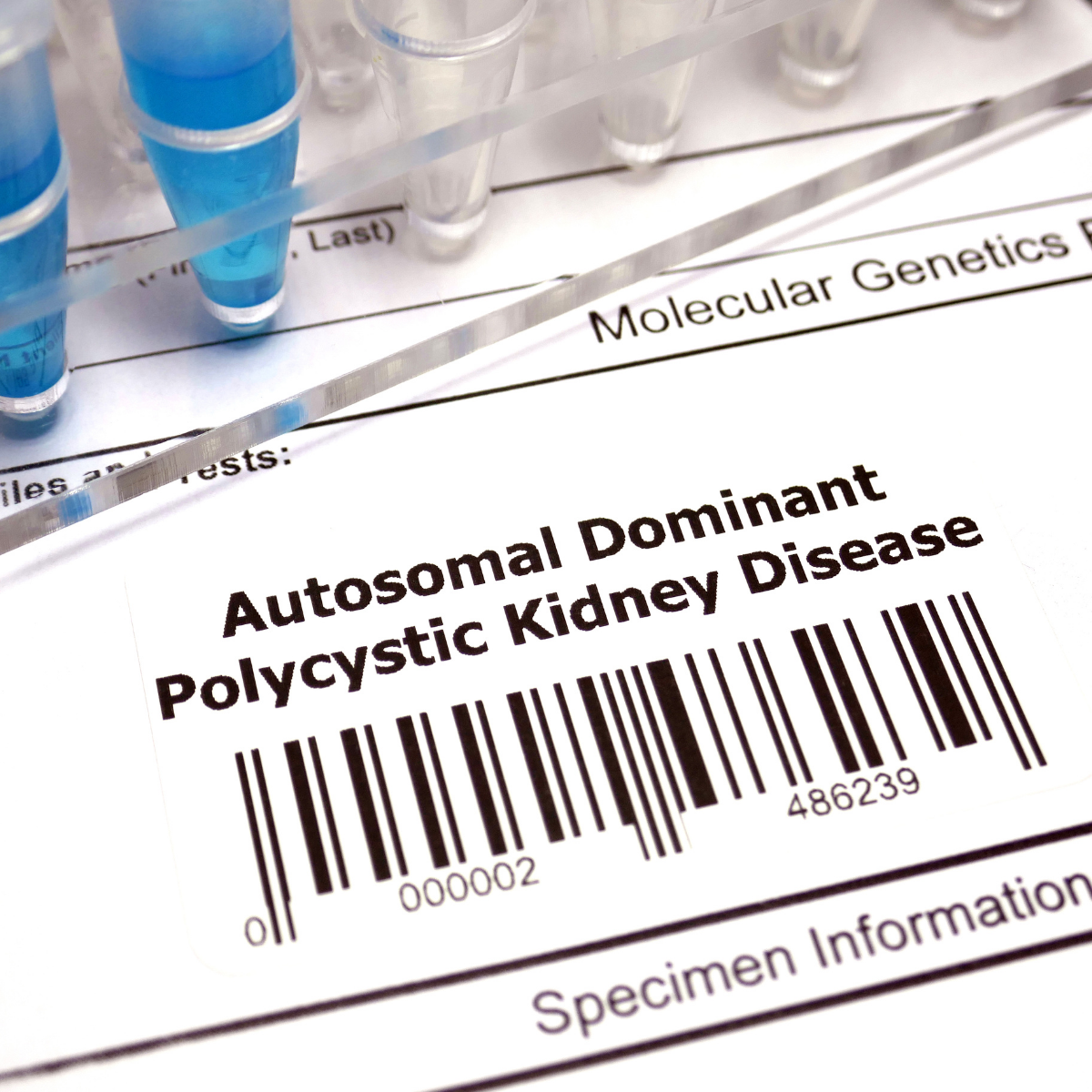 Polycystic Kidney Disease