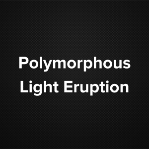 Polymorphous Light Eruption